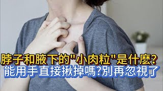 脖子和腋下的“小肉粒”是什麽？能用手直接揪掉嗎？別再忽視了