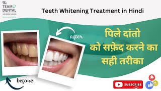 पिले दांतो को सफ़ेद करने का सही तरीका |Teeth Whitening Treatment in Hindi | Dr. Samidha Patil