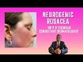 Neurogenic rosacea