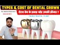 Types of dental crowns and cost in India ? Cost of dental crowns in Guwahati | Dr. Ashish Sharma