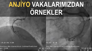 Anjiyo Vakalarımızdan Örnekler