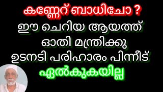 കണ്ണേറ് ബാധിച്ചാൽ പെട്ടന്ന് പരിഹാരം|കൺ വിഷം |#ake speech