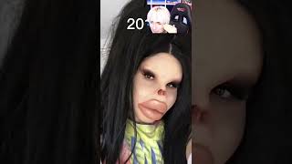 Worst Plastic Surgery Shorts