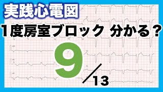 【心電図 読み方 ⑨】PQ間隔 PQ短縮　1度房室ブロック