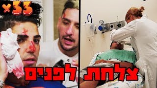 הוא שבר לו את הפנים