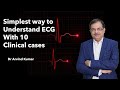 Simplifying ECG Understanding: 10 Clinical Cases Explained Lucidly