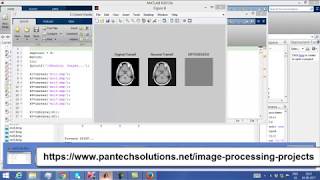 Matlab code for 3D SPIHT Image Compression