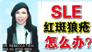 SLE红斑狼疮怎么办？Dr. Rebecca Tiew