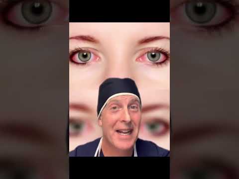 What are brownish blue eyes called?