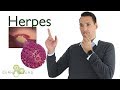 Was ist Herpes? Was hilft? - Gerne Gesund