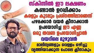 സ്കിന്നിൽ ഈ ലക്ഷണം കണ്ടാൽ ഉറപ്പിക്കാം കരളും കുടലും പ്രശ്നത്തിലാണെന്ന്. ഇതൊന്ന്  ചെയ്തു നോക്കു |