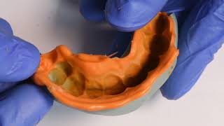Conventional silicone index obtained from 3D-printed mock up .