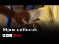 Mpox declared public health emergency in Africa | BBC News