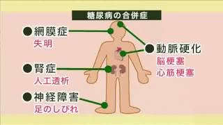 健康ぷらざ：糖尿病の予防と治療①（2013.2.3）