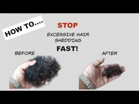 Stop Excessive Hair Shedding| Tea Rinse| Natural Hair - YouTube