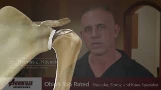 Surgical Options for Shoulder Arthritis
