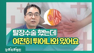 탈장수술 궁금증은 여기서! 기침·부종·항생제·소아·임산부🙋🏻‍♂️👨🏻‍⚕️