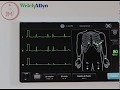 How to Use the Welch Allyn CP150 EKG Machine and Product Features