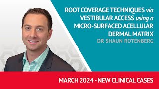 Root Coverage Techniques via Vestibular Access using a Micro-Surfaced Acellular Dermal Matrix - V2