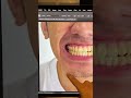 Easiest Way to Whiten Teeth in Photoshop! #Shorts