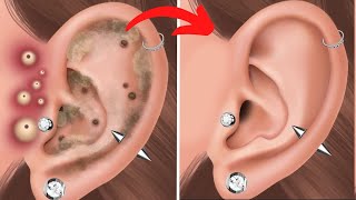 [ASMR] Ear plugs removal and deep cleaning animation | smile bam | brain asmr | asmr sound | tinysom