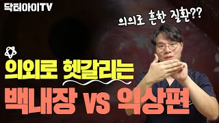 의외로 백내장으로 혼동하기 쉬운 '익상편', 생각보다 흔하고 심각할 수 있습니다. 안과 전문의가 알려주는 익상편 증상 및 치료!