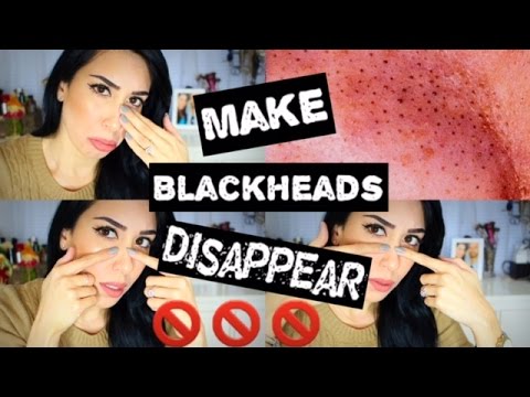 How To GET RID OF BLACKHEADS | 5 DIY Ways & DEMOS How To GET RID OF BLACKHEADS | 5 DIY Ways & DEMOS