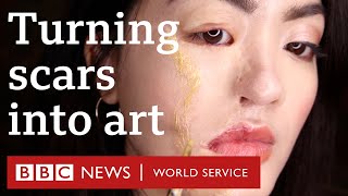 'My scars are beautiful' - BBC World Service