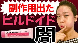 【ヒルドイドの闇】使い続けた結果…アトピー悪化。添付文を簡単に解説