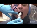 RINN Snap-A-Ray DS Endo Placement | Dentsply Sirona