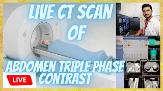 CT SCAN Triple phase Abdomen Contrast Scanning process || Live CT Scan of Triphasic Abdomen #ctscan