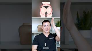 4 Types of BBL Surgery | Dr. Johnson C. Lee | Beverly Hills, CA