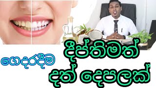 අව පැහැ වූ දත් ක්ෂණිකව සුදු කරගන්න | Remove stain for bright teeth | Nutritionist Hiroshan jayaranga