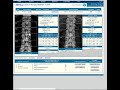 Quick Review and Report of DXA Bone Density test