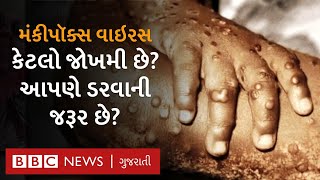 મંકીપૉક્સ વાઇરસ શું છે? તેનાં લક્ષણો શું હોય છે? અને કઈ રીતે ફેલાય છે? Monkeypox