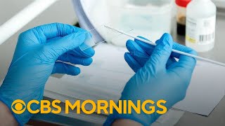 New cervical cancer screening guidelines suggest women can participate in collecting sample