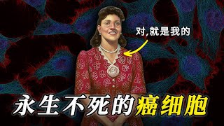 这是人类发现的第一个永生细胞，1000年后，它也许还在继续分裂