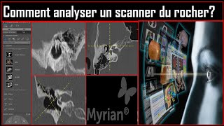 Comment analyser un scanner du rocher?