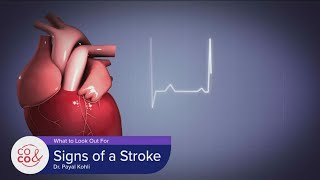 Dr. Kohli - Signs of a Stroke - February 21, 2023