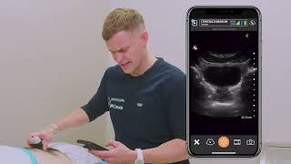 Clarius C3 HD3 convex wireless ultrasound scanner. ⭐