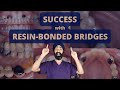 Success with Resin Bonded Bridges (aka Adhesive Bridges or formerly Maryland) - PDP132