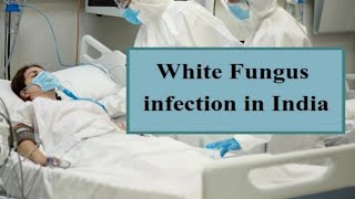 white fungus ഞെട്ടലിൽ രാജ്യം / എന്താണ് വൈറ്റ് ഫംഗസ് ലക്ഷണങ്ങൾ