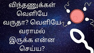 விந்தணுக்கள் வெளியேவருதா? வெளியே வராமல்இருக்க என்ன செய்ய?/ sperm leakage @RainbowTalk91