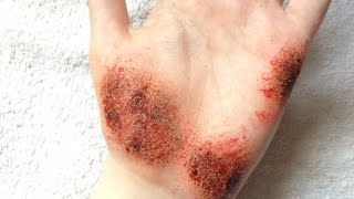 Grazed Hand - Special Effects Make Up