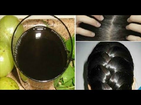 No More Chemicals! Say Goodbye To Gray Hair With These Natural Remedies That Are Worth Trying No More Chemicals! Say Goodbye To Gray Hair With These Natural Remedies That Are Worth Trying