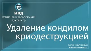 190  Удаление кондилом криодеструкцией