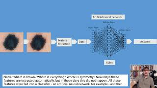 Artificial intelligence in skin cancer diagnosis | Prof Harald Kittler
