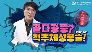 소리 없는 뼈 도둑, 골다공증의 모든 것! - 약 부작용부터 임플란트, 치료법까지!