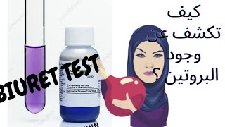 Biuret test   ( اختبار بيوريت ( كاشف البروتينات العام