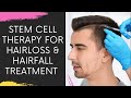 Adipocyte derived Stem Cells conditioned media therapy for Hair loss #shorts